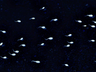 Mr Jonathan Ramsay Azoospermia